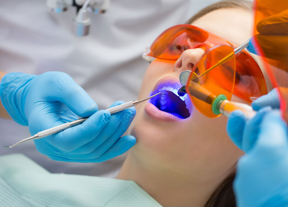 Fillings Accudental Clinica Dental